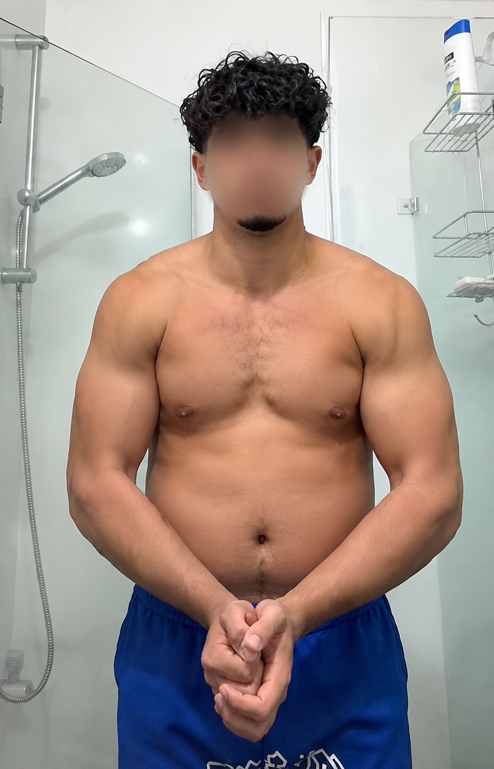 Before progress photo, face blurred